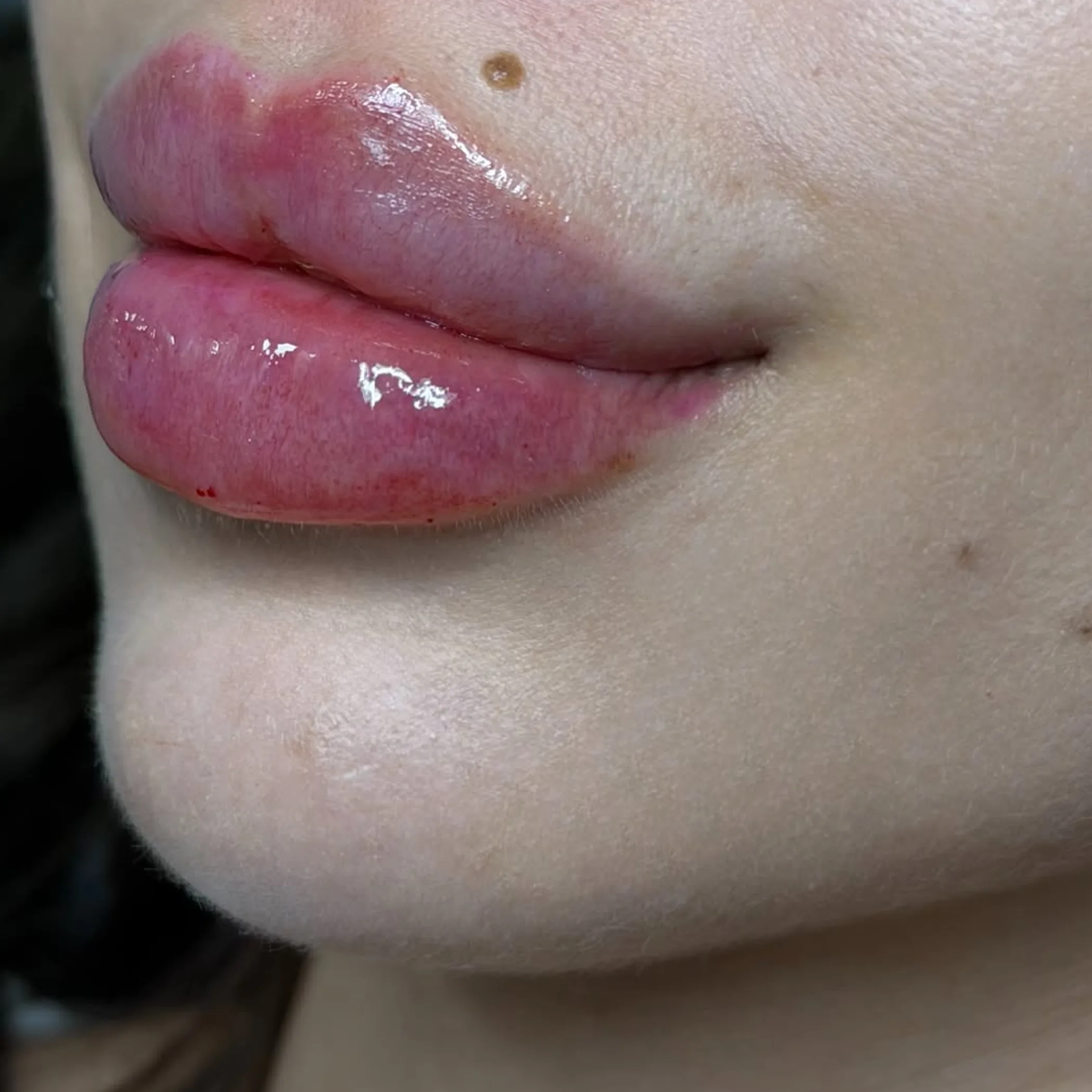 lips after lip blush treatment